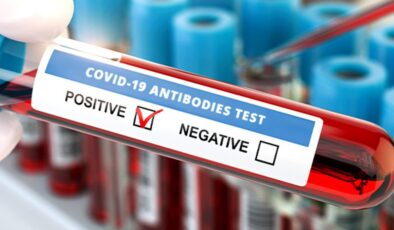Koronavirüs verileri açıklandı: 176 can kaybı, 9 bin 138 yeni vaka