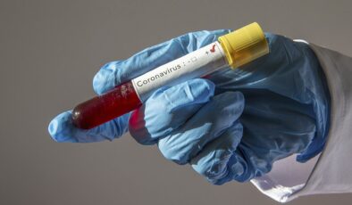 Koronavirüs verileri açıklandı: 181 can kaybı, 9 bin 537 yeni vaka