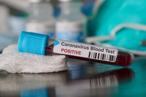 Sağlık Bakanlığı Corona virüsü (koronavirüs) için son gelişmeleri ve Türkiye