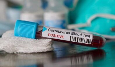 Koronavirüs verileri açıklandı: 191 can kaybı, 13 bin 830 yeni vaka
