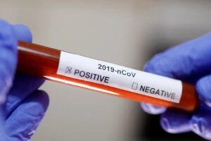 Sağlık Bakanı Fahrettin Koca 5 Ocak 2021 günlük corona virüs tablosunu