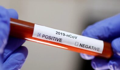 Koronavirüs verileri açıklandı: 194 can kaybı, 14 bin 494 yeni vaka