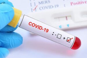 Sağlık Bakanlığı Corona virüsü (koronavirüs) için son gelişmeleri ve Türkiye