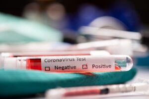 T&uuml;rkiye'de son 24 saatte 181 bin 199 Covid-19 testi yapıldı,