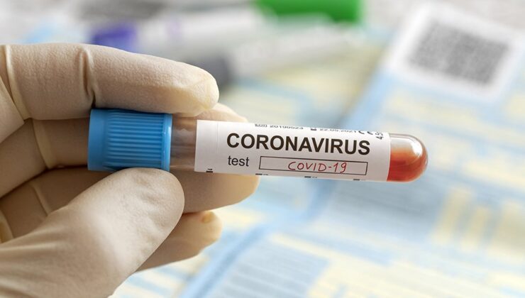 Koronavirüs verileri açıklandı: 220 can kaybı, 30 bin 424 yeni vaka