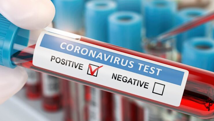 Koronavirüs verileri açıklandı: 222 can kaybı, 29 bin 136 yeni vaka