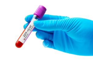 Sağlık Bakanlığı Corona virüsü (koronavirüs) için son gelişmeleri ve Türkiye