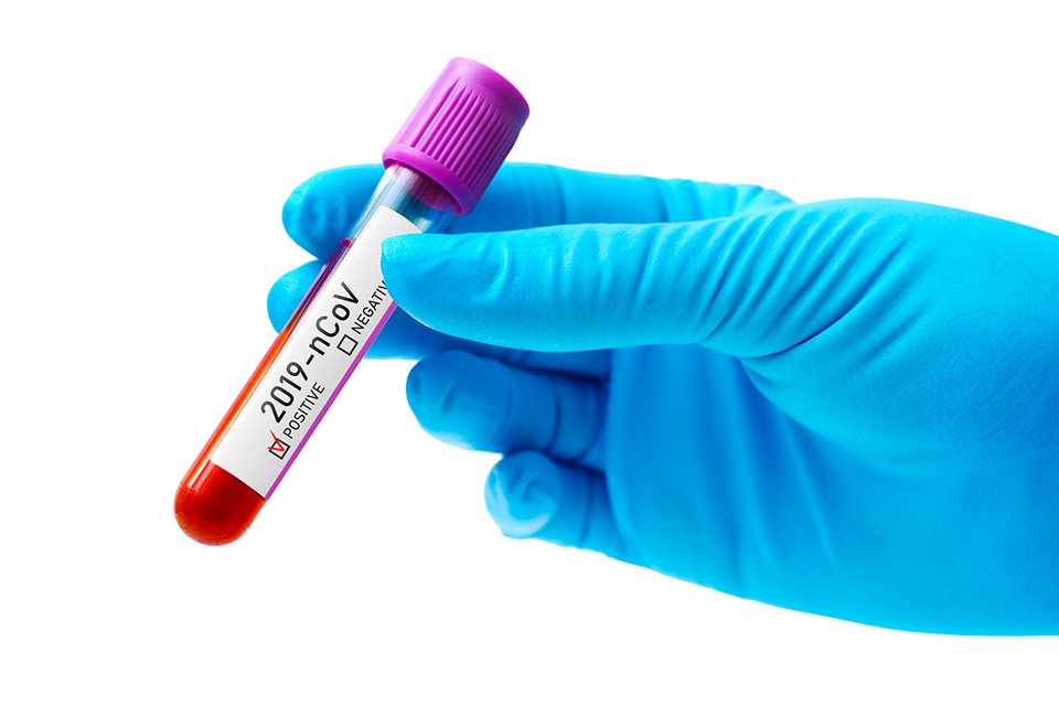 Sağlık Bakanlığı Corona virüsü (koronavirüs) için son gelişmeleri ve Türkiye