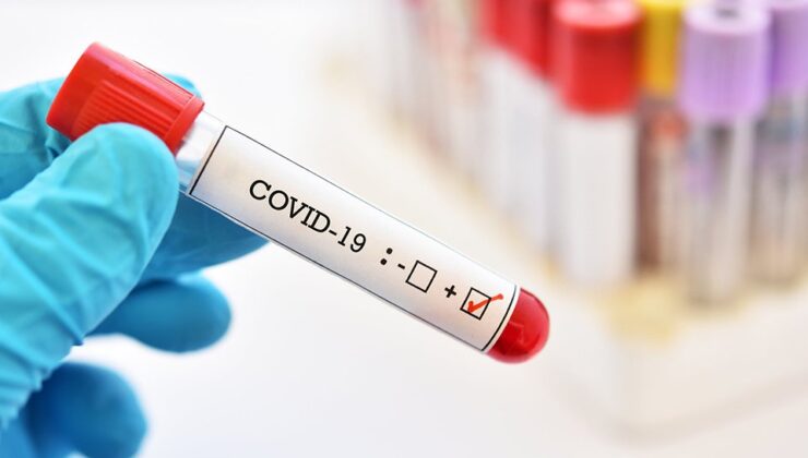 Koronavirüs verileri açıklandı: 240 can kaybı, 29 bin 718 yeni vaka