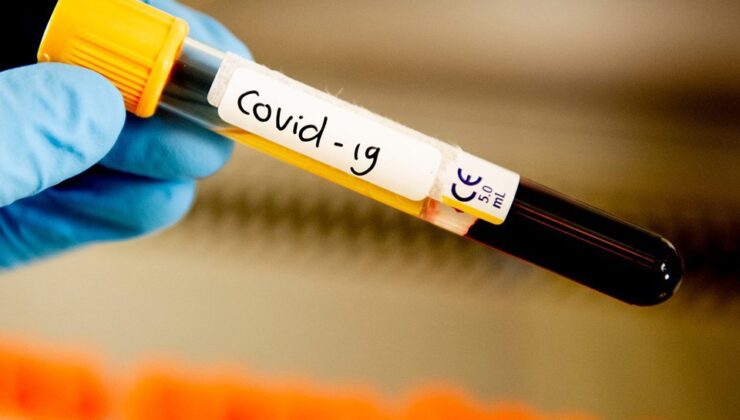 Koronavirüs verileri açıklandı: 241 can kaybı, 22 bin 195 yeni vaka