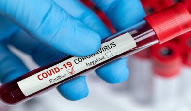 Koronavirüs verileri açıklandı: 246 can kaybı, 20 bin 316 yeni vaka