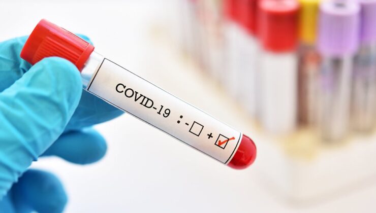 Koronavirüs verileri açıklandı: 246 can kaybı, 26 bin 410 yeni vaka