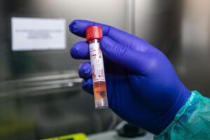 Sağlık Bakanı Fahrettin Koca, Corona virüsü (koronavirüs) ile ilgili son