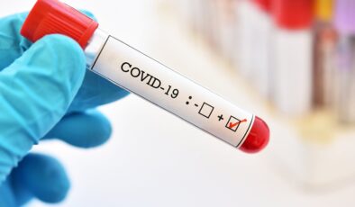 Koronavirüs verileri açıklandı: 254 can kaybı, 18 bin 102 yeni vaka