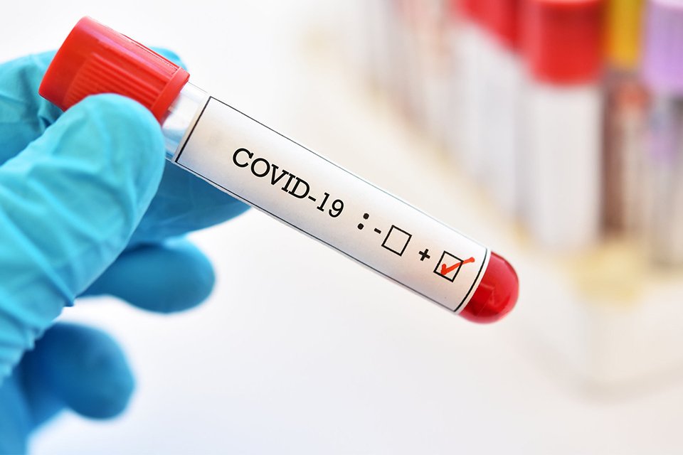 Sağlık Bakanlığı Corona virüsü (koronavirüs) için son gelişmeleri ve Türkiye