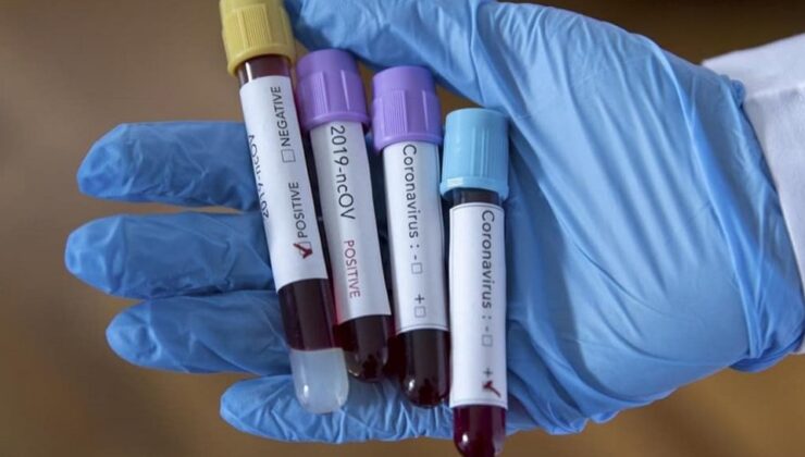 Koronavirüs verileri açıklandı: 254 can kaybı, 19 bin 103 vaka
