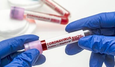 Koronavirüs verileri açıklandı: 257 can kaybı, 15 bin 197 yeni vaka