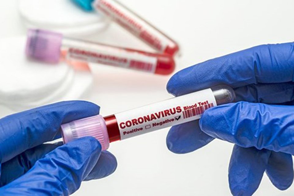 T&uuml;rkiye'de son 24 saatte 180 bin 892 Covid-19 testi yapıldı,