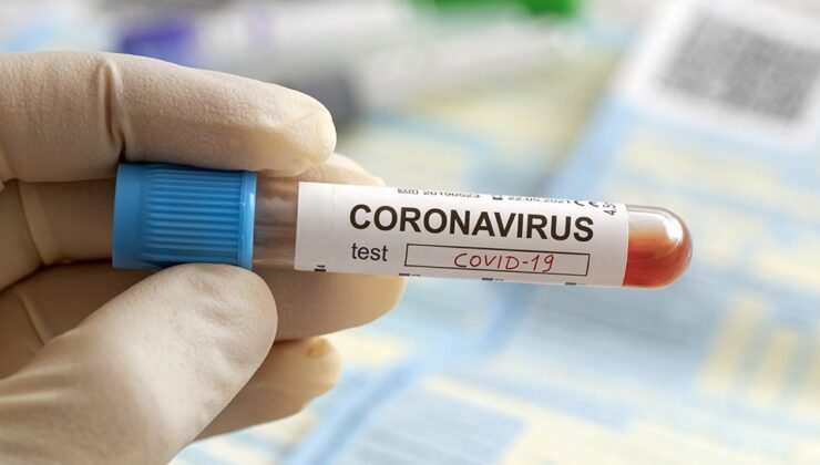 Koronavirüs verileri açıklandı: 259 can kaybı, 19 bin 650 yeni vaka