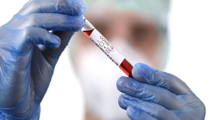 Koronavirüs verileri açıklandı: 276 can kaybı, 27 bin 802 yeni vaka