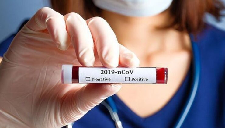 Koronavirüs verileri açıklandı: 353 can kaybı, 37 bin 312 yeni vaka