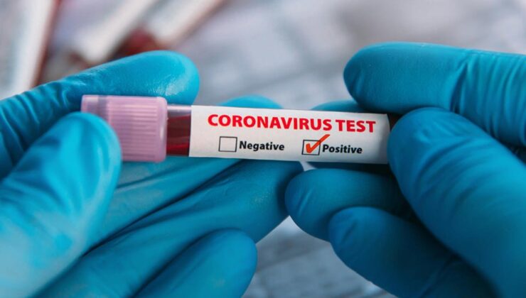 Koronavirüs verileri açıklandı: 73 can kaybı, 9 bin 572 yeni vaka
