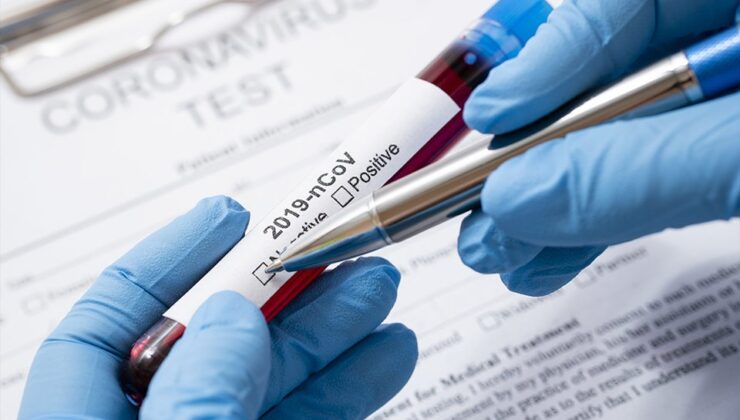 Koronavirüs verileri açıklandı: 75 can kaybı, 9 bin 107 yeni vaka