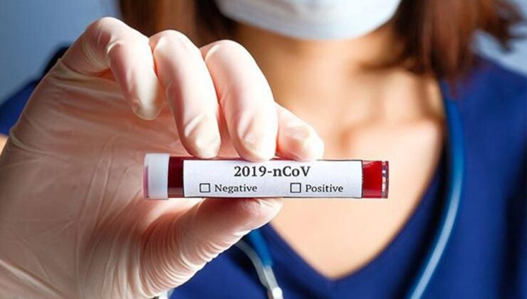 Koronavirüs verileri açıklandı: 80 can kaybı, 7 bin 857 yeni vaka
