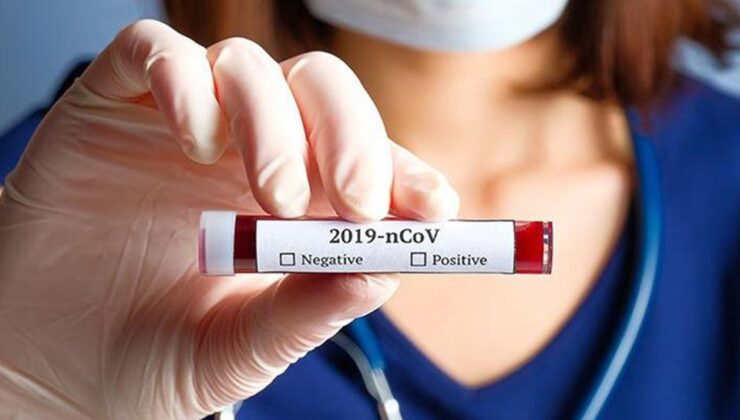 Koronavirüs verileri açıklandı: 82 can kaybı, 7 bin 419 yeni vaka