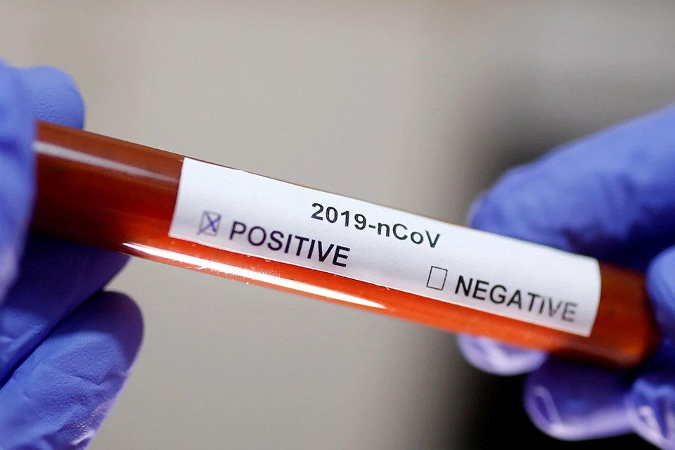 Sağlık Bakanlığı koronavirüs için son gelişmeleri ve günlük korona tablosunu