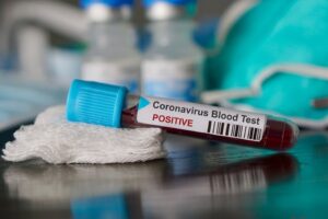 Sağlık Bakanlığı, koronavir&uuml;s i&ccedil;in son gelişmeleri ve g&uuml;nl&uuml;k tabloyu paylaştı.