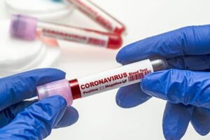 Sağlık Bakanlığı, Türkiye Günlük Korona Tablosu'nu açıkladı. Vaka ve vefat