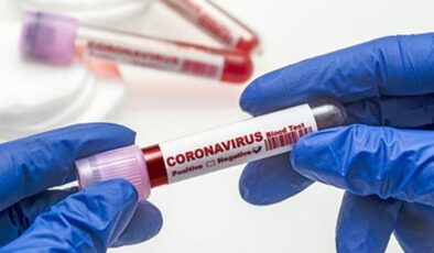 Koronavirüs verileri açıklandı: Vaka sayısı 12 binin altında