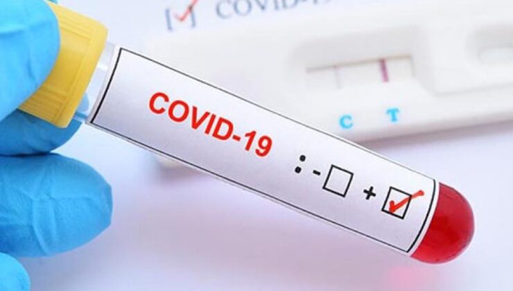 Koronavirüs verileri açıklandı: Vaka sayısı 15 binin üzerinde