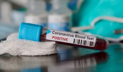 Koronavirüs verileri açıklandı: Vaka sayısı 30 bini geçti