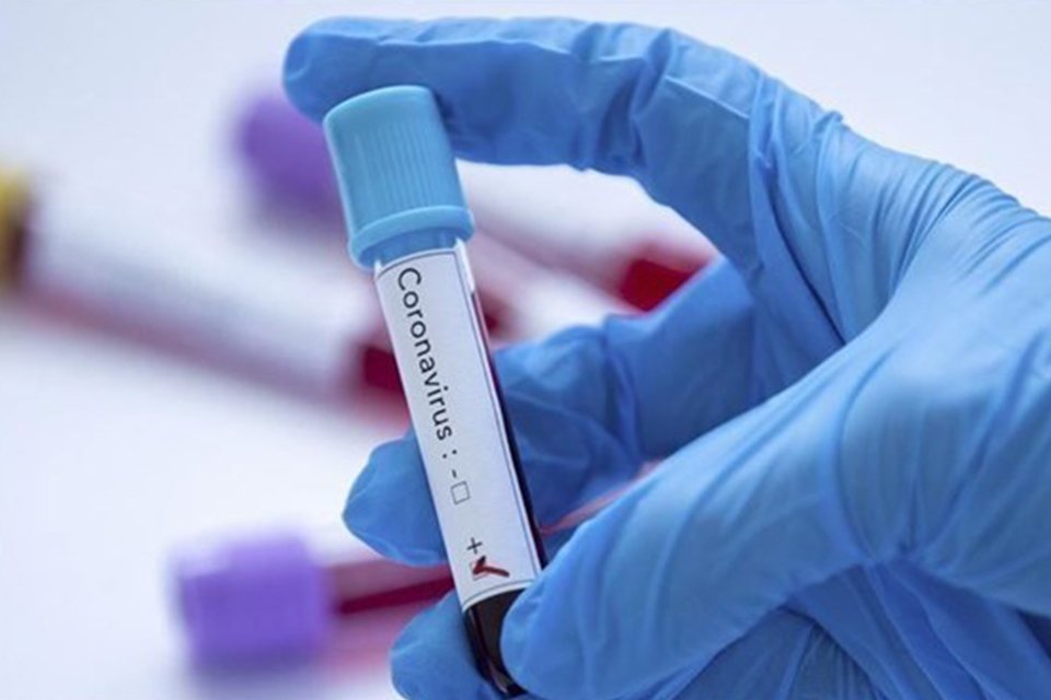 Sağlık Bakanlığı, koronavir&uuml;s i&ccedil;in son gelişmeleri ve g&uuml;nl&uuml;k tabloyu paylaştı.