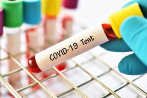 Sağlık Bakanlığı, günlük koronavirüs tablosunu açıkladı. Tabloda vaka sayısı 6