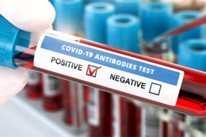 Sağlık Bakanlığı, Türkiye günlük koronavirüs tablosunu açıkladı. Vaka sayılarındaki düşüş