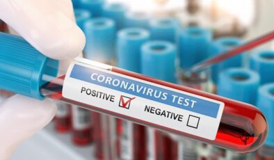 Koronavirüs verileri açıklandı: Vaka sayısı tekrar 7 binin üzerinde
