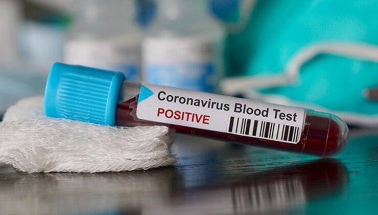 Koronavirüste kritik seviye devam ediyor: 253 can kaybı, 55 bin 791 yeni vaka