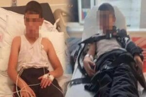 Bitlis'te sokak k&ouml;peklerinin ısırması sonucu kuduz ş&uuml;phesi konulan 10 yaşındaki