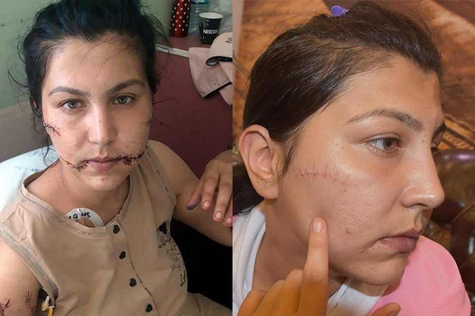 İZMİR'in Buca il&ccedil;esinde, dini nikahla yaşadığı Aysel Perkg&uuml;n'&uuml; (28) darbedip