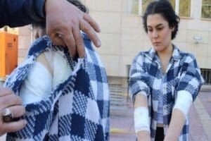 Nevşehir'de, &uuml;niversite &ouml;ğrencisi K&uuml;bra Nayman'a (20), okula giderken başıboş k&ouml;pekler