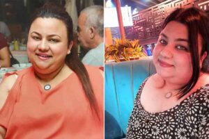 İZMİR'de &Ouml;zge Mitoğlu&rsquo;nun (28) mide k&uuml;&ccedil;&uuml;ltme ameliyatı olduktan bir s&uuml;re