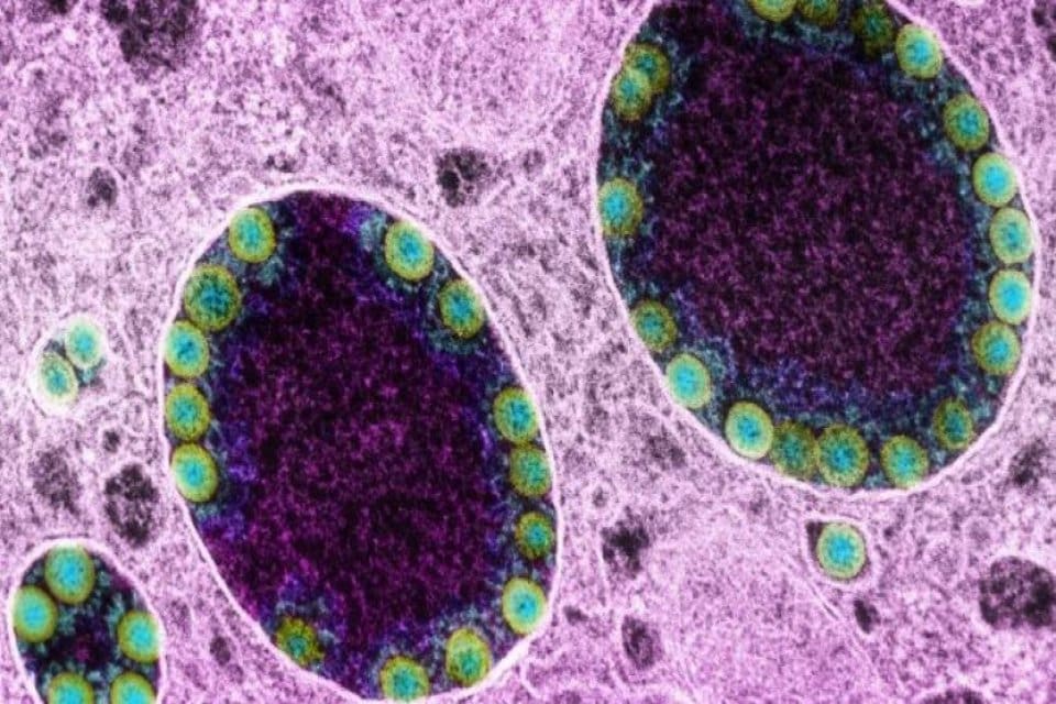 D&uuml;nya &ccedil;apında 6 milyondan fazla insanın &ouml;l&uuml;m&uuml;ne sebep olan corona