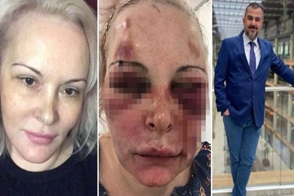 Sosyal medya &uuml;zerinden tanışıp sevgili olduğu Alp Mutlu tarafından otelde