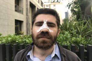 Hastasına istediği raporu vermeyen bir aile hekimi, İstanbul Kadık&ouml;y'de saldırıya