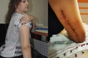 İZMİR'in Gaziemir il&ccedil;esinde kız arkadaşı Işıl Dalgı&ccedil;'ın (30) kolunu kıvırıp