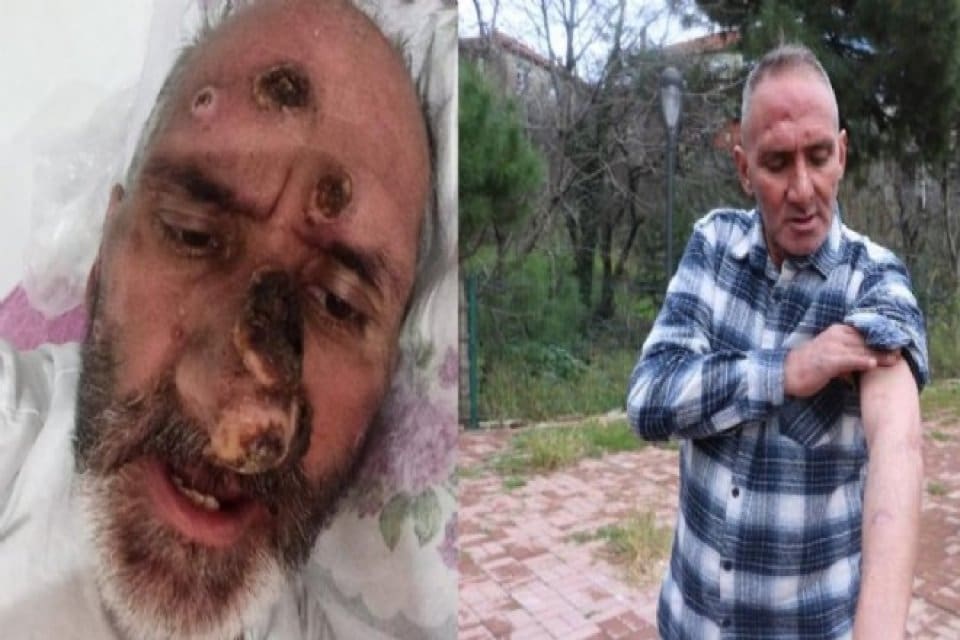 Zonguldak'ta yaşayan Murat Terzi&rsquo;nin (48) y&uuml;z&uuml;, &ccedil;alışmaya gittiği Antalya'da, Afrika