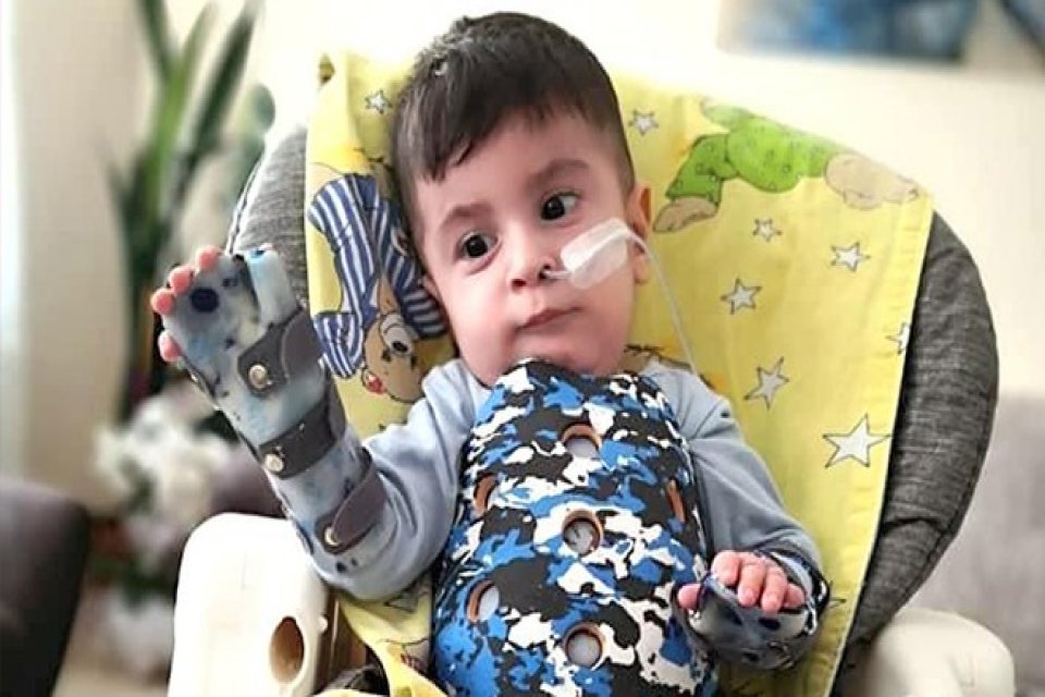 SMA Tip 1 hastası olan 18 aylık Kaan Efe için